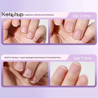 [Ktchup-t] 3In1 เซรามิคเล็บ Cuticle Oil Brighten Moisturizing เล็บ Cuticle Remover ปากกาบํารุงเล็บ Care Essence ปากกาซ่อม Damage Nice