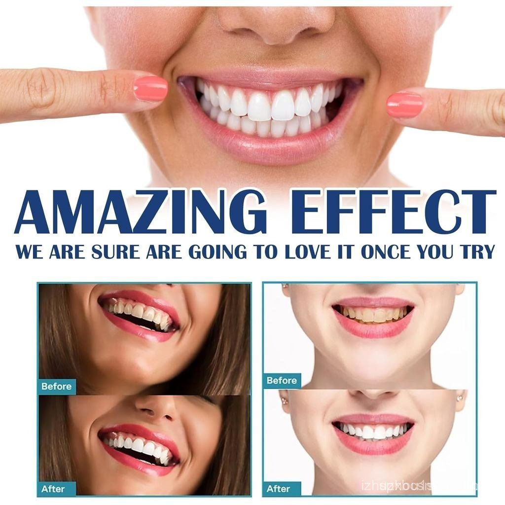 Tooth Paint Instant Whitening Dental Lacquer, Tooth Polish Uptight White, Whitening Teeth Paint, Pai