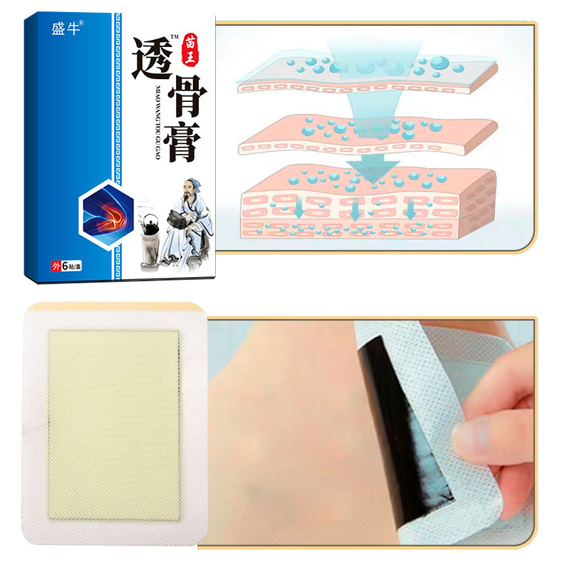 FFM Miaowang ครีมทากระดูกและกัดครีมกระดูกสันหลังส่วนคอไหล่รอบกระดูกสันหลังส่วนเอวข้อต่อขาไม่สบาย Sel