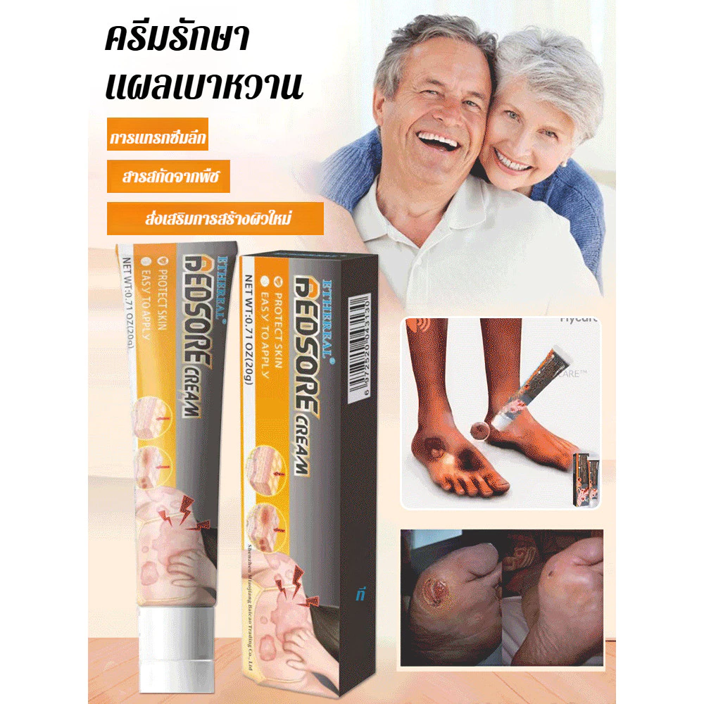 🔥สินค้าขายดี🔥 SL ครีมแผลเบาหวาน ฟื้นฟูแผลเร็ว ลดระดับน้ำตาล สำหรับผู้ป่วยเบาหวาน ของแท้💯
