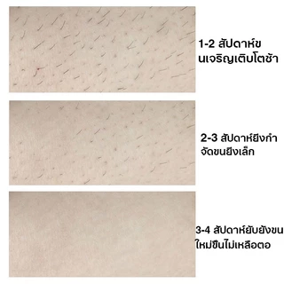 【ซื้อ 1 แถม 3】มูสกําจัดขน ครีมขจัดขน ครีมขจัดขนน้องสาว ครีมทารักแร้ แขน ขา และ รักแร้ มูสกําจัดขน สำหรับผู้ชายและผู้หญ