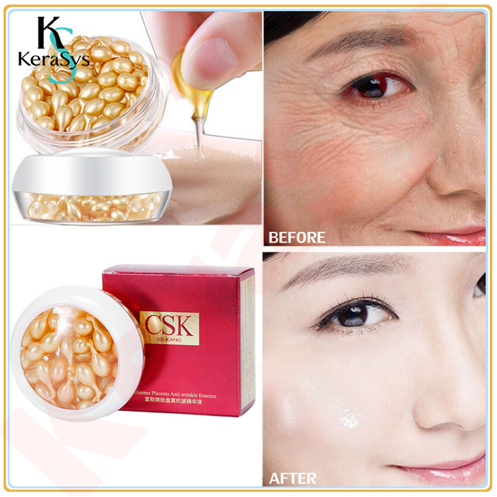 KeraSys เซรั่มกระชับหน้า, เซรั่ม CSK, เซรั่ม CSK, Thyroid Capsules 30PCS, เซรั่มกระชับ, ลบริ้วรอย, เ