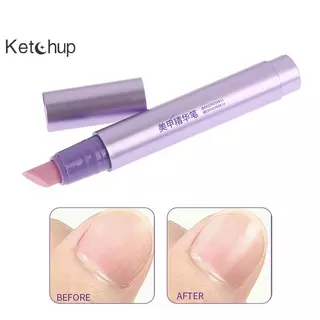 [Ktchup-t] 3In1 เซรามิคเล็บ Cuticle Oil Brighten Moisturizing เล็บ Cuticle Remover ปากกาบํารุงเล็บ Care Essence ปากกาซ่อม Damage Nice