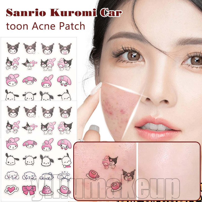 SANRIO 20/10/5 แผ่นการ์ตูนเจลน้ําแผ่นแปะสิว - ลาย ซานริโอ คุโรมิ - แผ่นแปะรักษาสิว - สติ๊กเกอร์กําจัดสิว - สติ๊กเกอร์กาวในตัว - เครื่องมือเสริมความงาม - กันน้ํา ระบายอากา