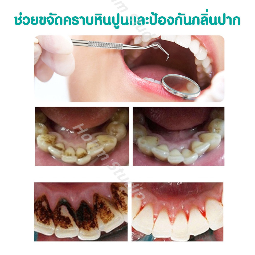 พร้อมส่ง ชุดขูดหินปูน ที่ขูดหินปูน แปรงขูดหินปูน ชุดดูแลสุขภาพช่องปาก ชุดทำความสะอาดช่องปาก อุปกรณ์ดูแลช่องปาก เซ็ต6ชิ้น ราคา ถูกที่สุด ดีลบีเคเค แกลเลอรีภาพที่ 5