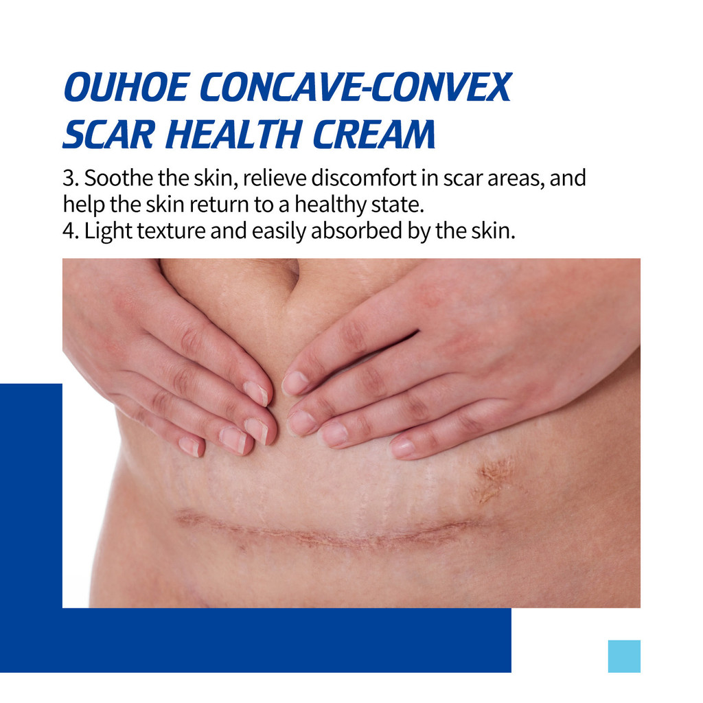 OUHOE Skin Scar Care Cream Smooth Skin Scar Scar Skin Care Cream 2025/12/23