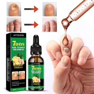 ฆ่าเชื้อราที่เล็ Jaysuing 30ml เซรั่มทาเล็บ nail repair serum น้ำมันทาเล็บ เซรั่มทาเล็บเสีย ออยทาเล็บ เล็บเท้า