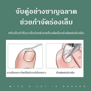 ⚡️⚡️กรรไกรตัดเล็บ ที่ตัดเล็บขบ กรรไกรตัดเล็บขบ ที่ตัดหนังเล็บ กรรไกรสแตนเลส กรรไกตัดหนัง ปลายโค้งแหลม กรรไกรแต่งเล
