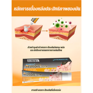 🔥สินค้าขายดี🔥 SL ครีมแผลเบาหวาน ฟื้นฟูแผลเร็ว ลดระดับน้ำตาล สำหรับผู้ป่วยเบาหวาน ของแท้💯