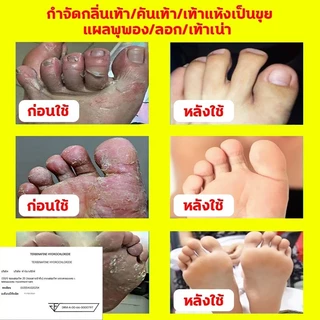 สูตรใหม่🦶ของแท้100%🦶 ครีมระงับกลิ่นเท้า ครีมบำรุงเท้า ครีมลดกลิ่นเท้า ครีมทาส้นแตก ครีมทาเท้า ครีมทาเท้าแตก foot