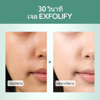 SHE Eureka เจลขัดผิว 50g x3 สูตรสมุนไพร Exfoliating Gel ผิวเรียบเนียน ลดความหมองคล้ำ เซ็ตสุดคุ้ม