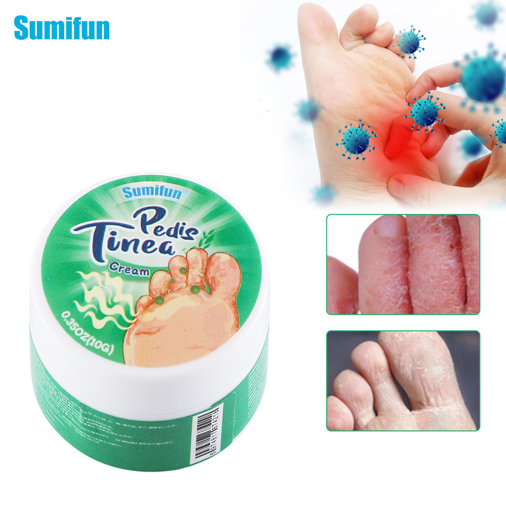 พร้อมสต็อก Fast Shipping Sumifuntemu Athletes Foot Cream Foot-ups กลิ่นเท้าอาการคัน Foot Care K20042