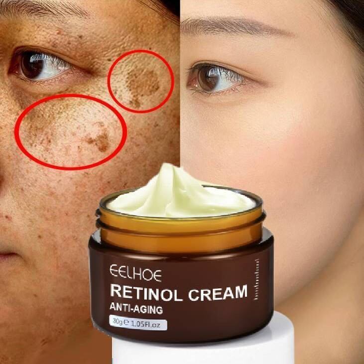 Eelhoe Retinol Face Cream Collagen Anti-Aging Anti-Wrinkle Firming Lifting Whitening Brightening Moi