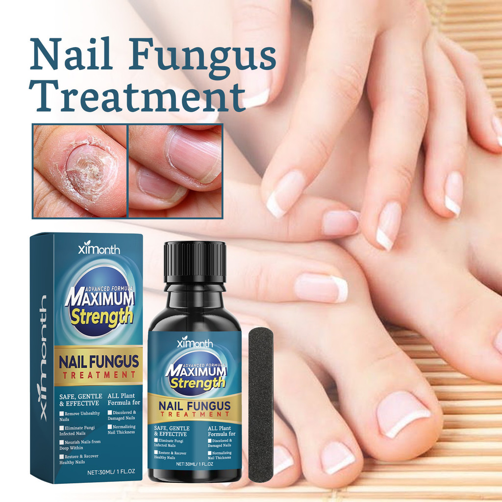 Ximonth Nail Repair Solution Inlay Thickening Brig Ximonth Liquid Liquid Liquid Liquid Liquid Liquid