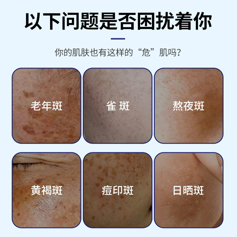 Dongda จุดผู้สูงอายุ Skin Spots Removal Cream Even Skin Color Cream จุดสี Suppression Cream CCC1219