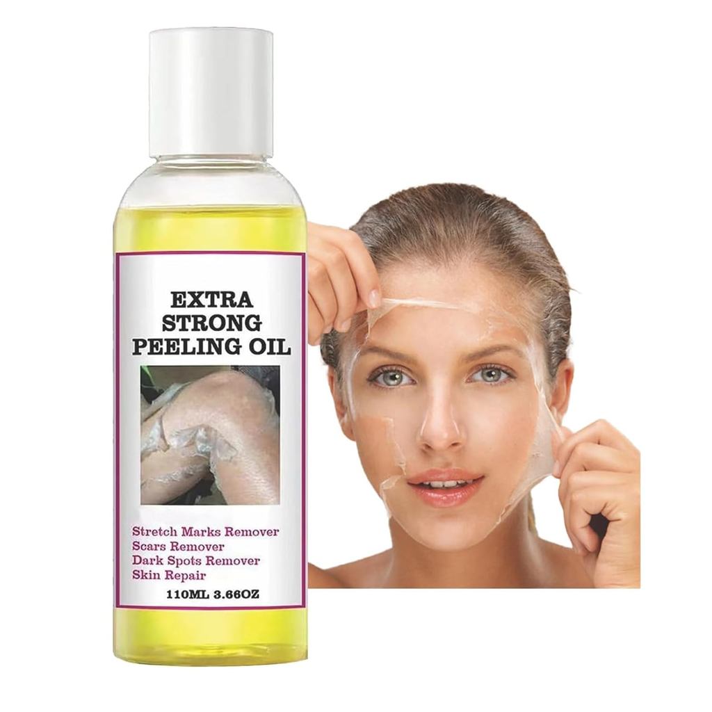 Generic Extra Strong Peeling Oil, Peeling Oil for Dark Skin, Yellow Peeling Oil, Exfoliating Peeling