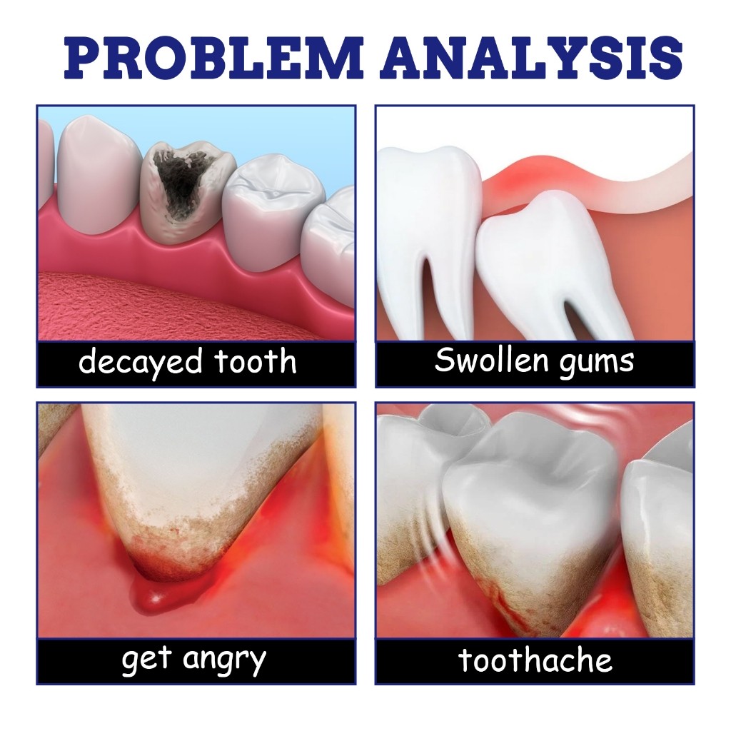 South Moon สเปรย์รักษาอาการปวดฟัน Toothache spray 20ml สเปรย์ดูแลช่องปาก แก้ปวดฟัน สเปรย์ฉีดฟัน เหงือกบวม ฟันผุ เสียวฟัน - รูปที่ 2