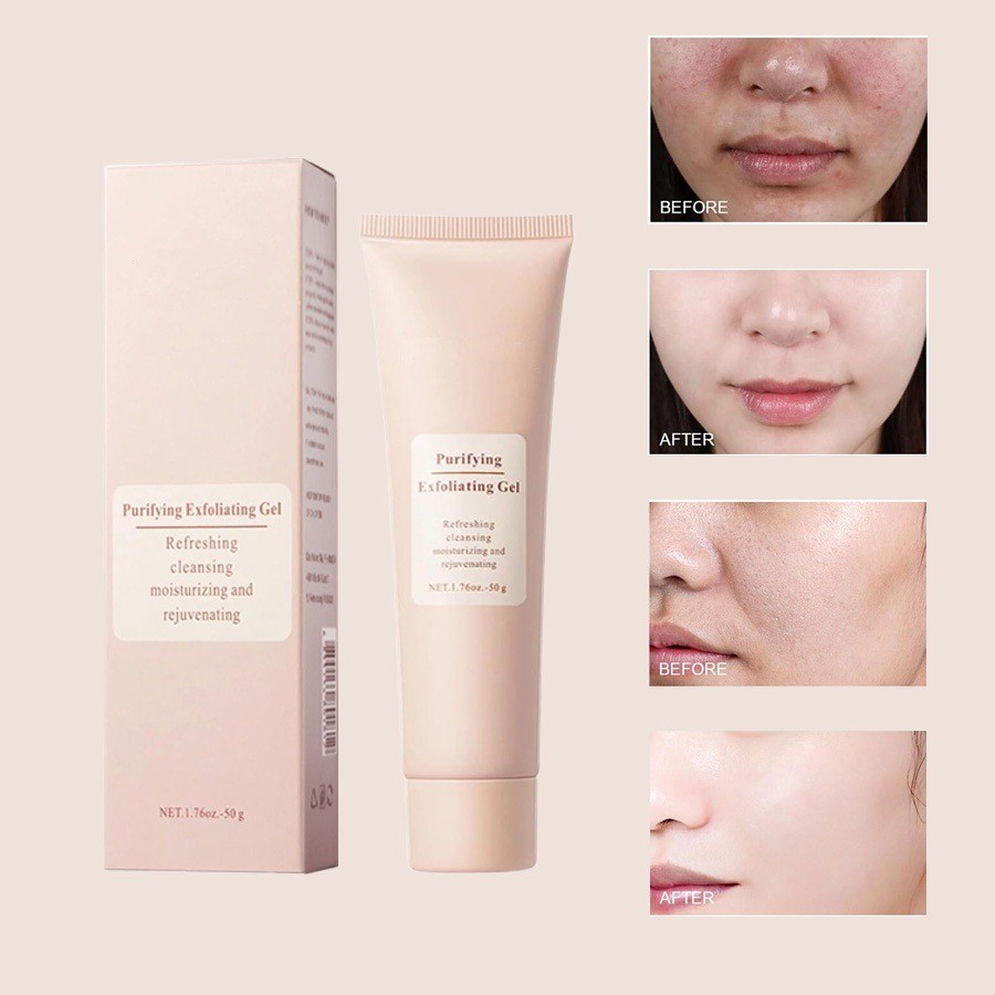 Exfoliating Gel Deep Cleansing Facial Gel Cream Moisturizing Moisturizing Cleansing Facial Scrub z04