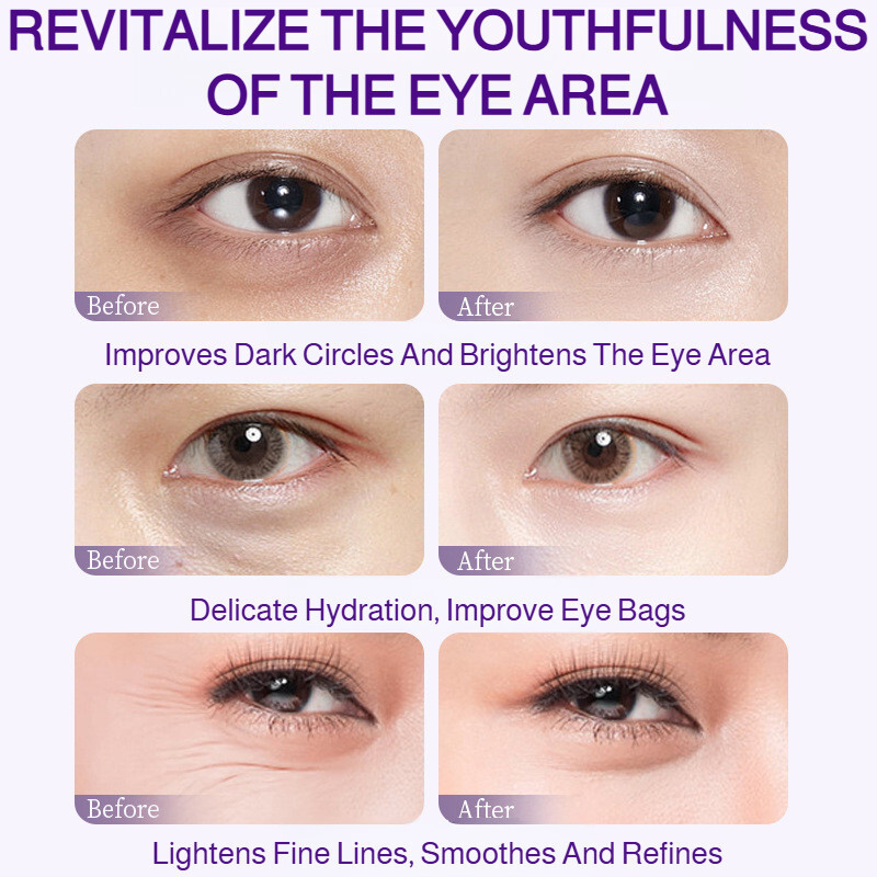 ☆优品·Eye AntiWrinkle Serum Stick ครีมบํารุงรอบดวงตาสดชื่นและไม่เหนียวเหนอะหนะ Dark Circles Hydration 