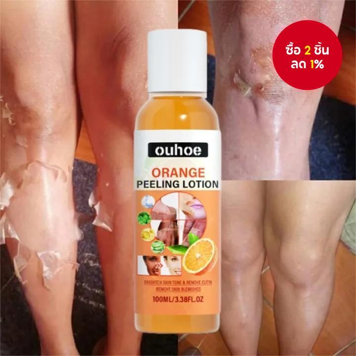 สีเหลือง Peeling Oil Bleaching Face Body Dark Skin Brighten Whiten โลชั่นมือเท้า Dead Skin Peel Exfo
