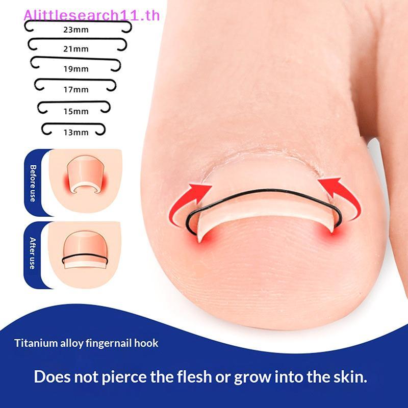 Alittlesearch11 2pcs คุด Toenail Corrector เครื่องมือ Pedicure กู้คืน Embed Toe Nail Treatment Profe