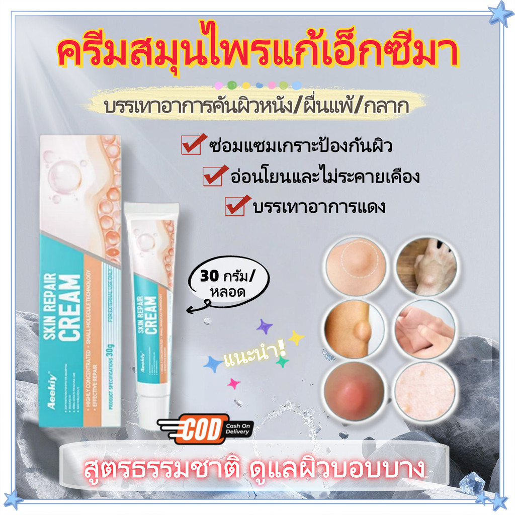 🚛จัดส่งรวดเร็ว- ครีมสมุนไพรแก้เอ็กซีมา 30 กรัม สูตรธรรมชาติ ซ่อมแซมผิวที่เสียหาย กลาก ผื่นคัน แดง