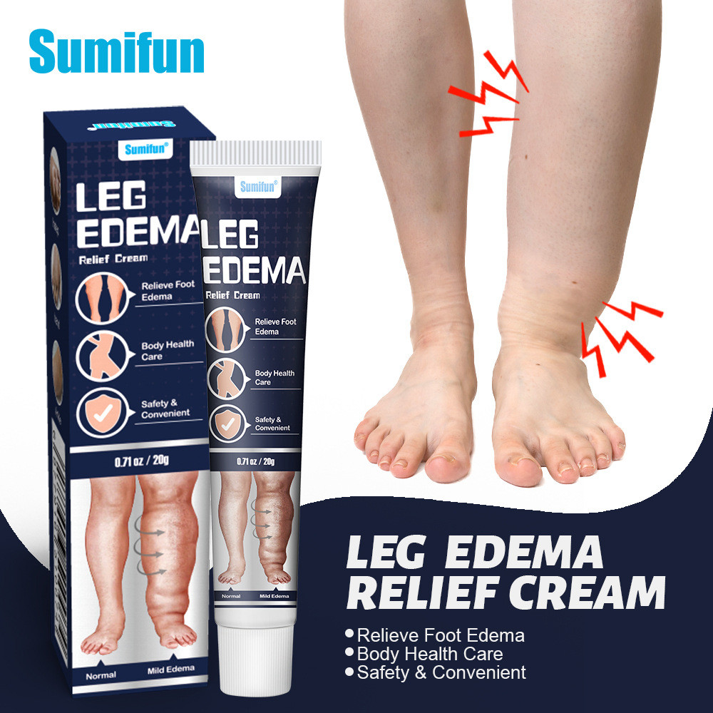 Shu Meifen ครีมลดบวม ขา Edema Foot Care