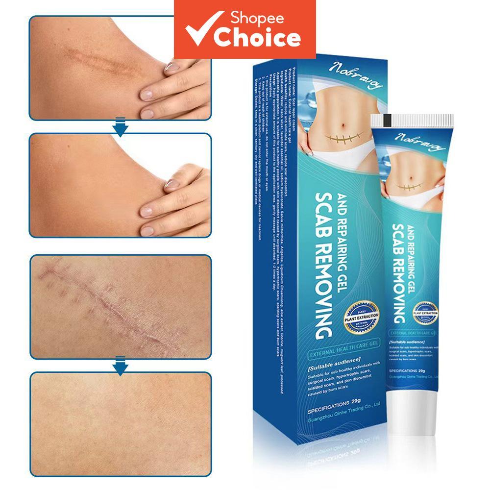 ครีมกําจัดรอยแผลเป็น เจลซิลิโคน สําหรับสิวผ่าตัด Burn C-Section Keloid Scar Repair 20g – โปรปัง