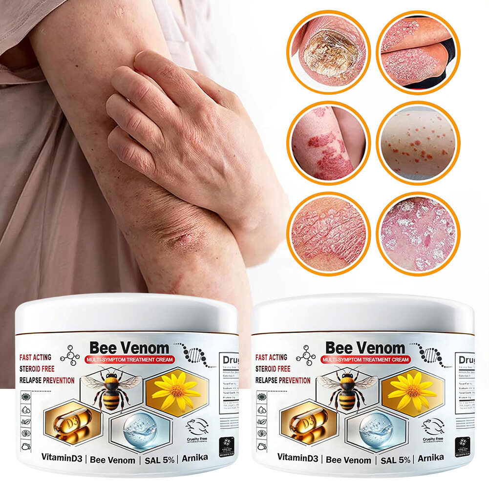 Cream Bee-Venom Multi-Symptom ปลอบประโลมและซ่อมแซมผิวแดง สําหรับผิวแดง