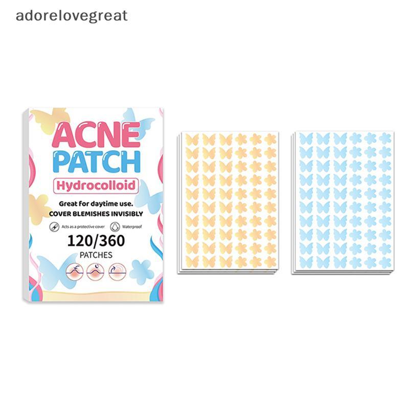 ALT 120/360 ชิ้นผีเสื้อรูปร่างสิวแพทช์สติกเกอร์ Blemish Spot คอนซีลเลอร์ 0.1 มม.รักษาสิว Pimple Remo