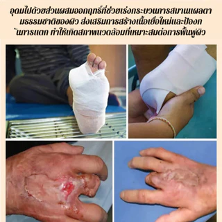 🔥สินค้าขายดี🔥 SL ครีมแผลเบาหวาน ฟื้นฟูแผลเร็ว ลดระดับน้ำตาล สำหรับผู้ป่วยเบาหวาน ของแท้💯