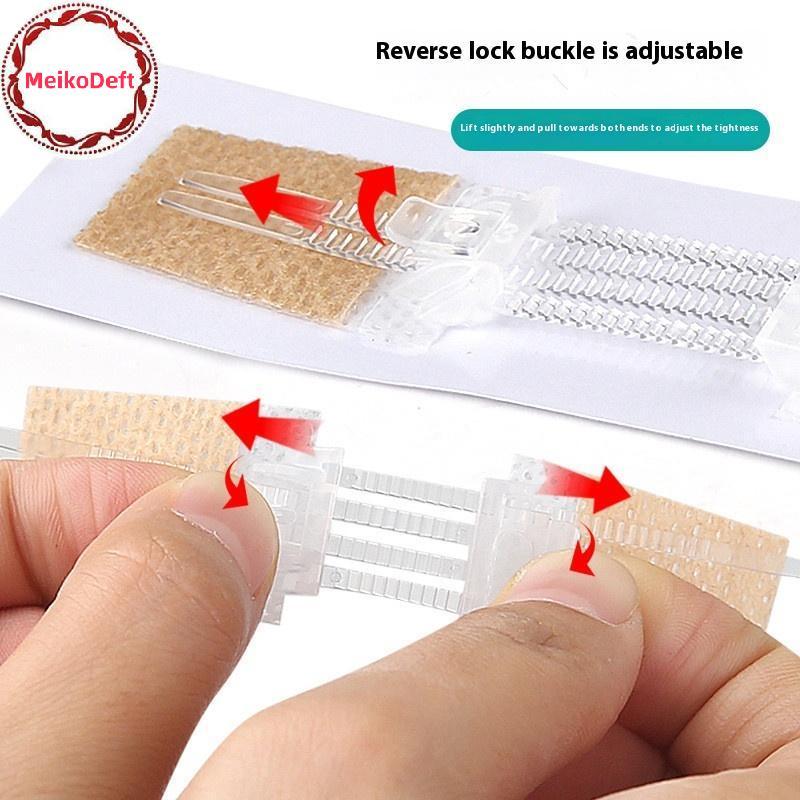 MeikoDeft ซิป Tie Wound ปิด Patch Hemostatic Patch Wound Fast ไม่มีเย็บซิปกลางแจ้ง Band-Aid แบบพกพา 