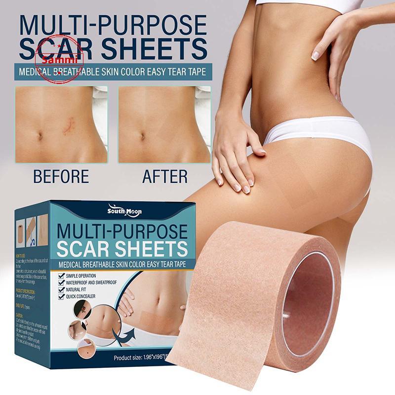 Sammi 1 ม้วนสีผิวโทนคอนซีลเลอร์ Tattoo Stiers Cover Up Tattoo Burn Scar Birthmark ที่มองไม่เห็น Patc