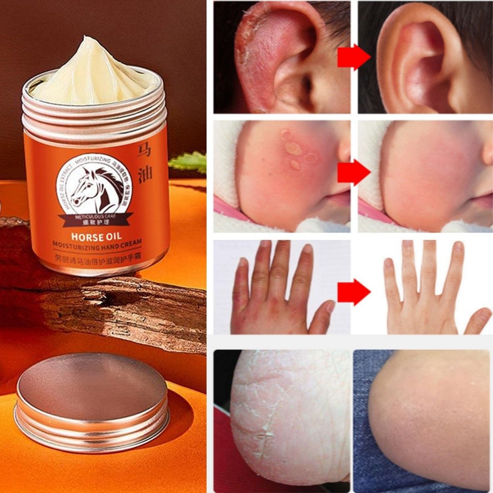 ลอริสครีมทามือและเท้า Horse Oil น้ำมันบำรุงผิวพรรณครีมทามือตราม้า ลดรอยแตกของมือแห้ง