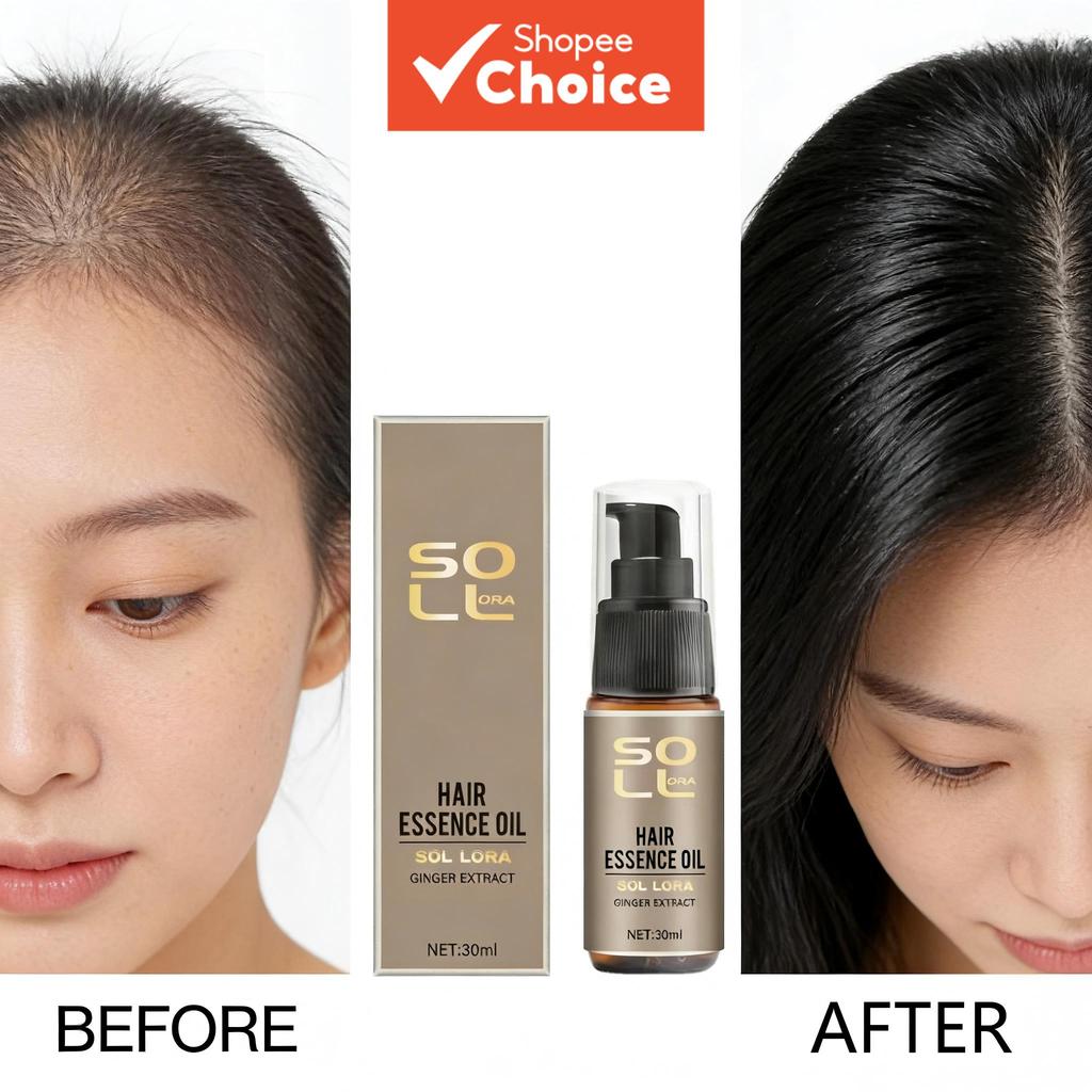 Ginger Hair Essence Oil, เซรั่มป้องกันผมร่วง บํารุงรากผมเพื่อผมหนาต้นฉบับ