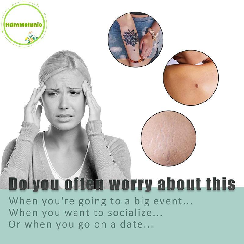 HDMM 1 ม้วนสีผิวโทนคอนซีลเลอร์ Tattoo Stiers Cover Up Tattoo Burn Scar Birthmark ที่มองไม่เห็น Patch