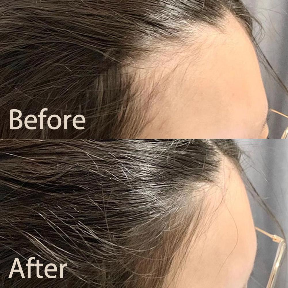 Hairline Filling Powders 2g สีดําธรรมชาติ/สีเทา/สีน้ําตาลอ่อนกันน้ํา Sweatproof T6c3