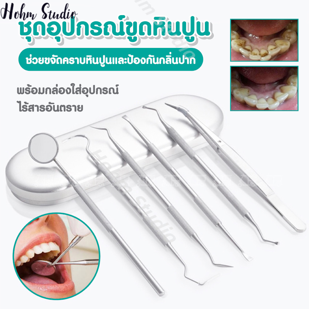 พร้อมส่ง ชุดขูดหินปูน ที่ขูดหินปูน แปรงขูดหินปูน ชุดดูแลสุขภาพช่องปาก ชุดทำความสะอาดช่องปาก อุปกรณ์ดูแลช่องปาก เซ็ต6ชิ้น ราคา ถูกที่สุด ดีลบีเคเค