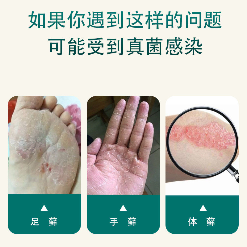 TOWNENG Industry Shell Polysaccharide Feet สเปรย์ง่ายสําหรับการติดเชื้อรามือเท้า/tanzhi5.7