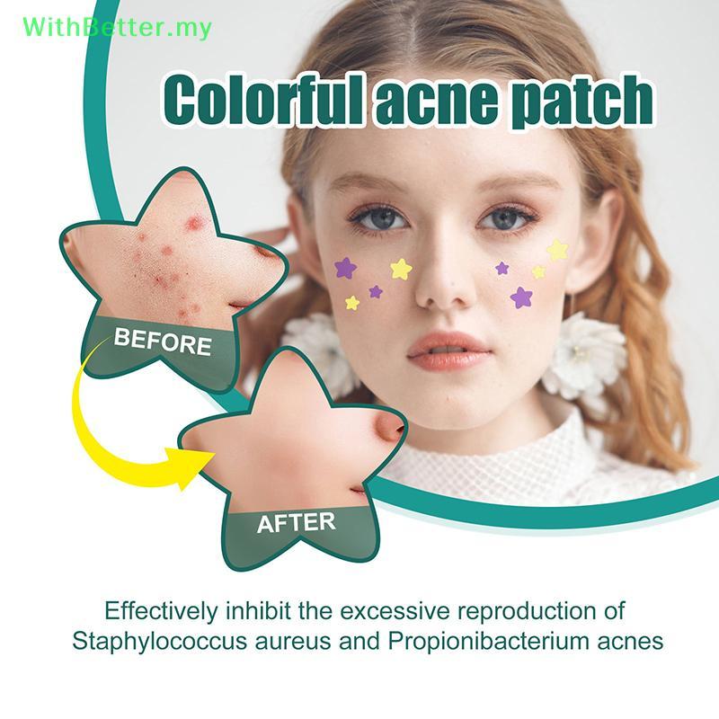 ด้วยดีกว่า 112 ชิ้นที่มีสีสันที่มองไม่เห็นสิว Patch ความงามสิวเครื่องมือสิวสิวคอนซีลเลอร์ Face Spot 