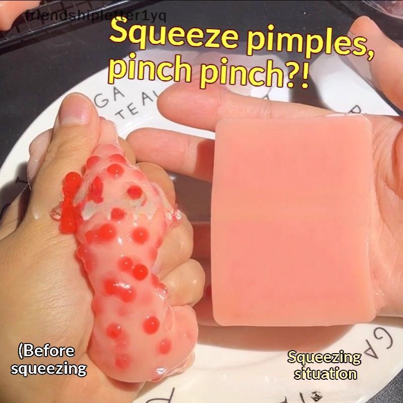 (แฟน) 2 ชิ้น Squishy Texture Pimple Popping ของเล่นบีบ Sensory Design ของเล่นนํากลับมาใช้ใหม่ Super Soft Fidget บรรเทาความวิตกกังวลของเล่น (TH)