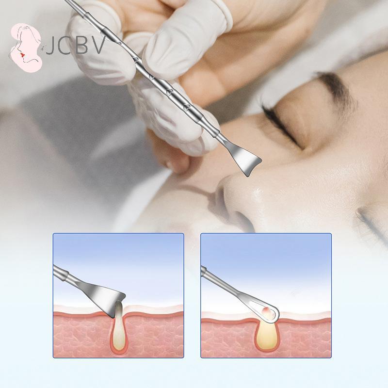 [JCBV] head Remover Pimple Popper Tool Removing Treatment Whitehead Popping Zit Nose Face Blemish Ex