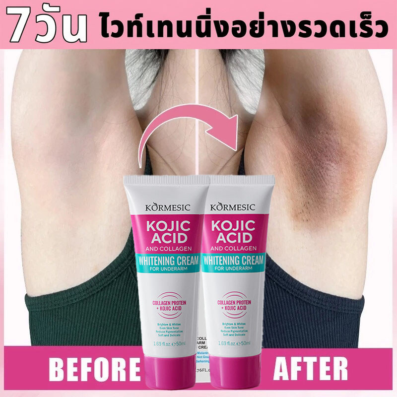 [Ready Stock] ครีมทารักแร้ขาว 50ml ครีมขาหนีบดำ แก้รักแร้ดำ ลดตุ่มหนังไก่ เข่า-ศอกดำ ครีมทาคอดำ ผิวขาวใส เห็นผลไว อ่อนโย