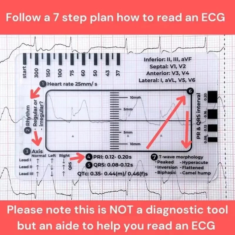 Ecg 7 Step Ruler 7 Step Scale สําหรับ Ecg สังเกตแบบพกพาโปร่งใส 7step ไม้บรรทัดเครื่องมือวัดไม้บรรทัด