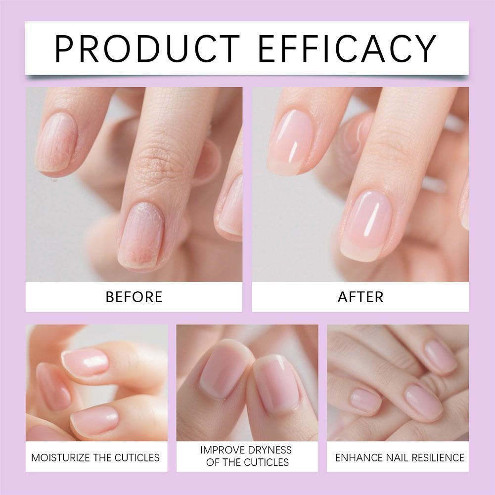 เล็บ Growth Oil ปากกา 2ml, Cuticle Care สําหรับเล็บเปราะอ่อน, Moisturizing Repair Care สําหรับแห้ง Y