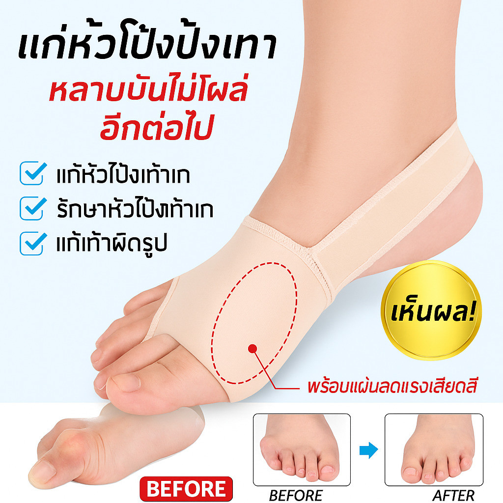 ✨ความสบายและประสิทธิภาพ/การแก้ไขนิ้วเท้า✨ SEBS อุปกรณ์แก้ไขนิ้วโป้งเท้าเบี่ยง/อุปกรณ์สุขภาพเท้าและแก้ไขนิ้วเท้า【แก้ไขนิ้วโป้งเท้าเบี่ยงอย่างมีประสิทธิภาพ/ปกป้องนิ้วเท้าจากก