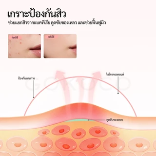 GOKOCO แผ่นแปะสิวน่ารัก 306 แผ่น 6 แผ่นต่อแพ็ค สิวอุดตัน สิวอักเสบ บรรจุแยกชิ้น ไฮโดรคอลลอยด์ กันน้ำ 24 ชม