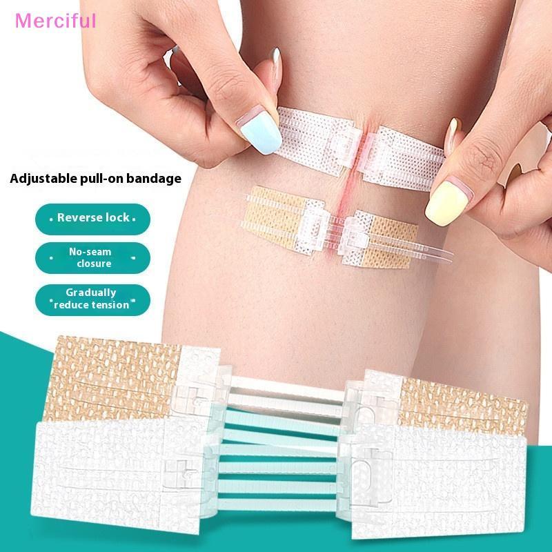 [Mer] Zipper Tie Wound Closed Patch Hemostatic Patch Wound Fast ไม่มีเย็บซิปกลางแจ้ง Band-Aid แบบพกพ
