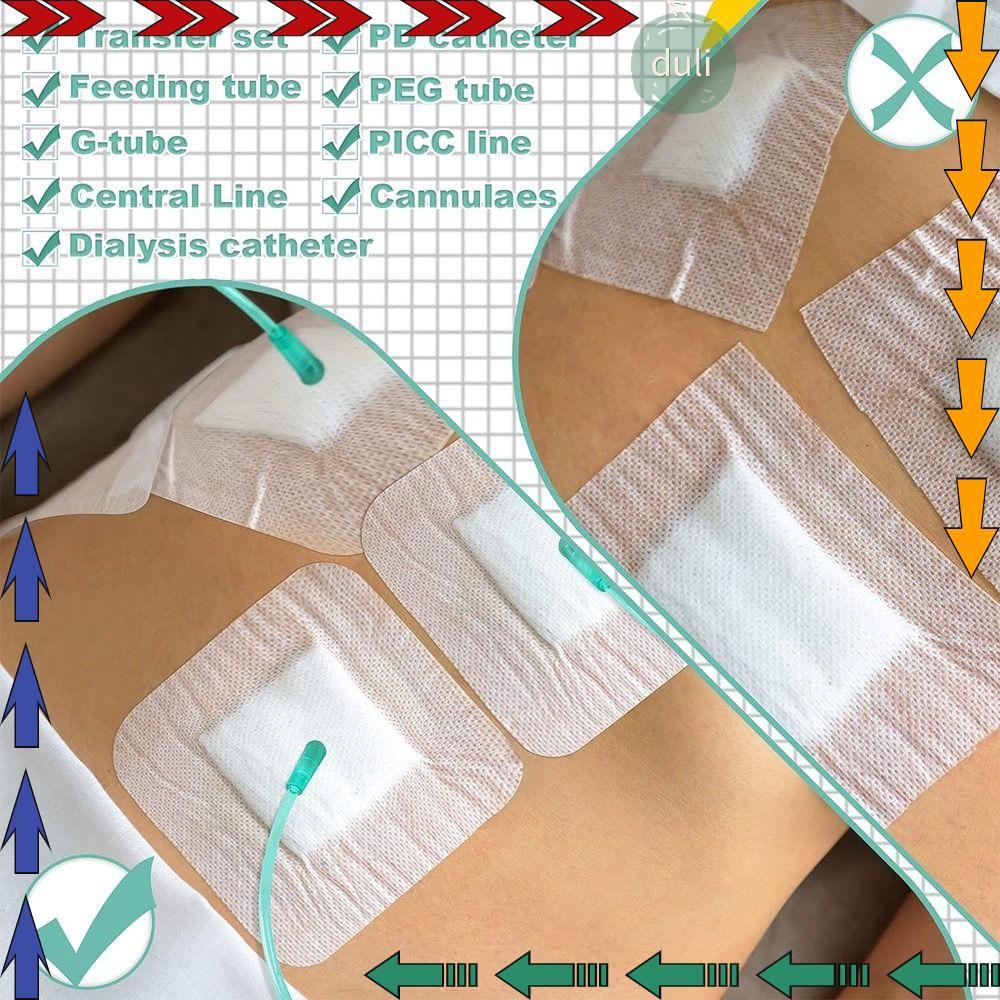 DUILIAN 10pcs Feeding Tube Pad, Gtube Supplies อุปกรณ์ไตเทียม Chest Catheter Cover, ทนทานไตเทียมแผลผ