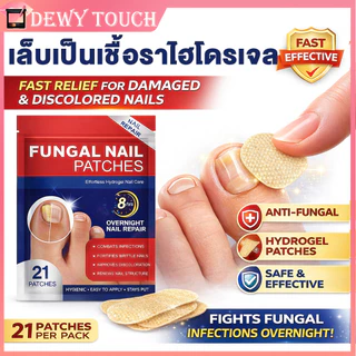✅แผ่นแปะเล็บเชื้อรา|แผ่นแปะเชื้อราที่เล็บ ซ่อมเล็บเสีย เล็บเชื้อรา เล็บขบ ทำให้เล็บสวย แข็งแรง สุขภาพดี